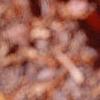 Fothergilla gardenii, fall color