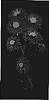 Chrysanthemum%20x%20morifolium%20%27Yocandle%27