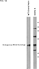 Musa%20acuminata%20%27QCAV-4%27